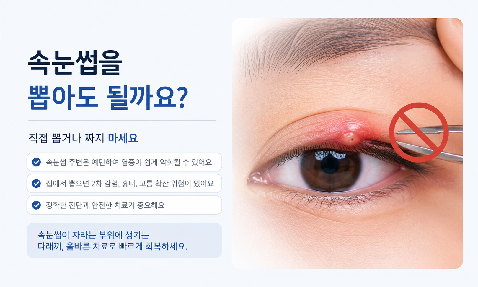 산본 다래끼, 속눈썹을 뽑으면 정말 빨리 나을까요?(군포안과)