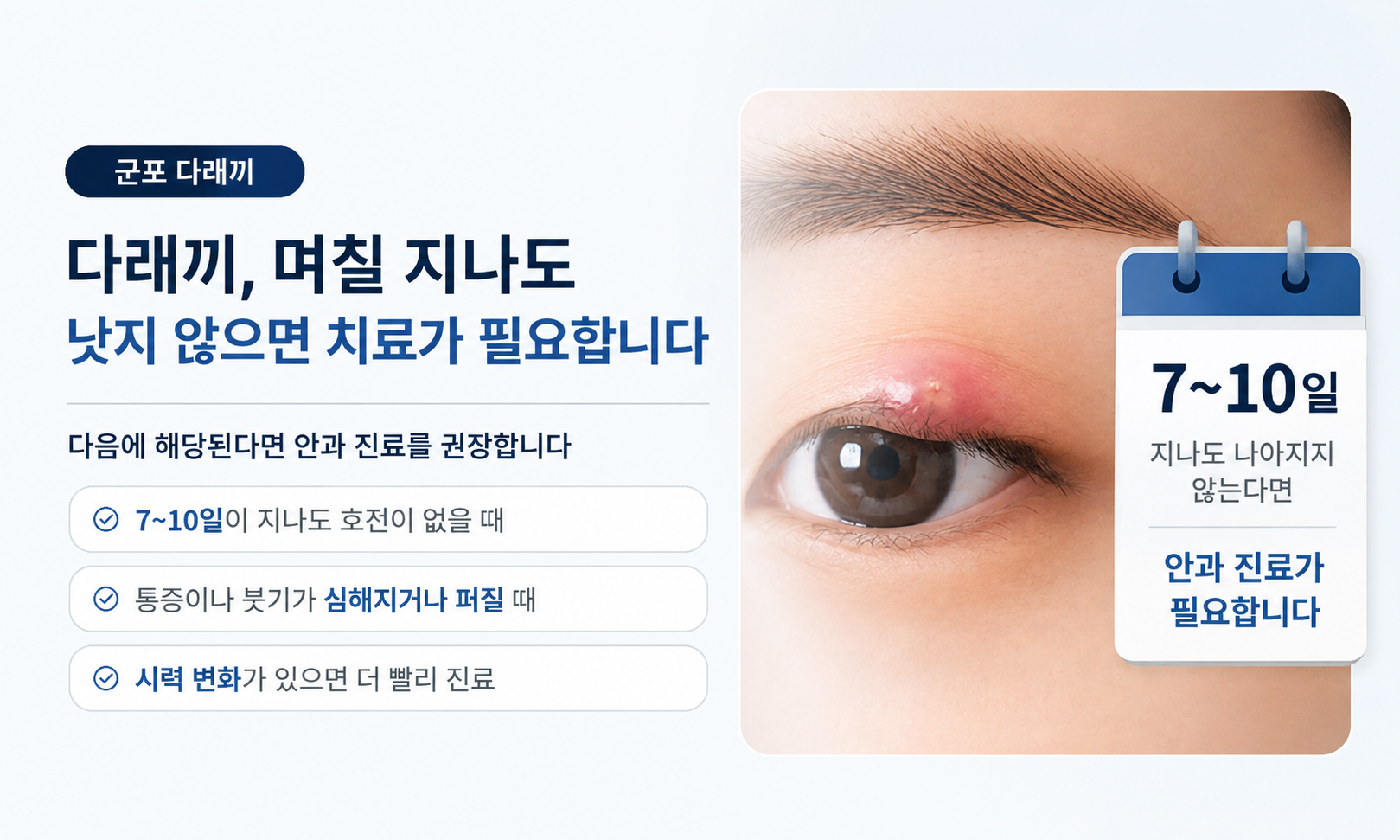 안양 평촌 범계 다래끼 안과, 일주일 정도 지나도 좋아지지 않는다면?