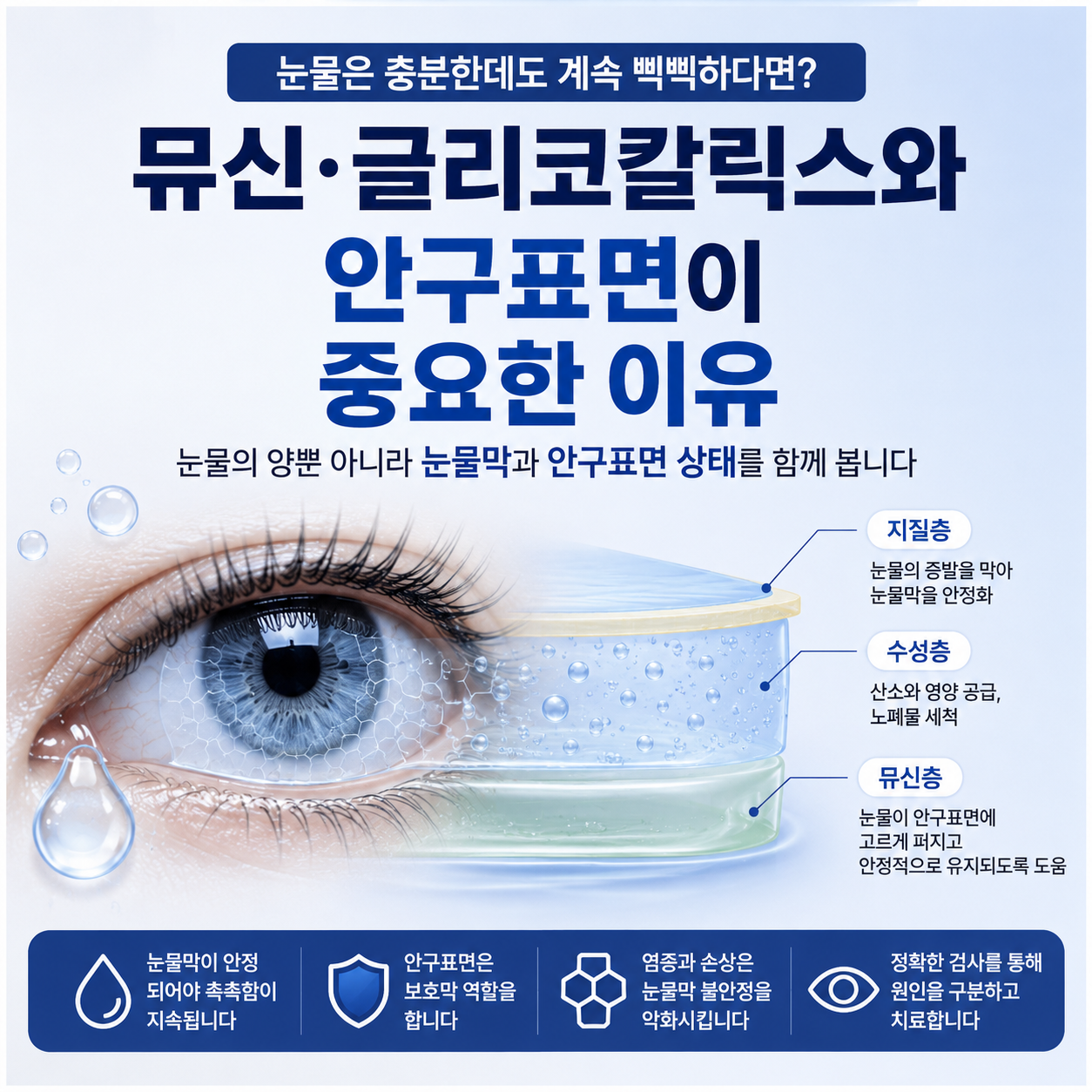 산본 안구건조증에서 뮤신과 글리코칼릭스, 안구표면의 역할을 설명하는 건강정보