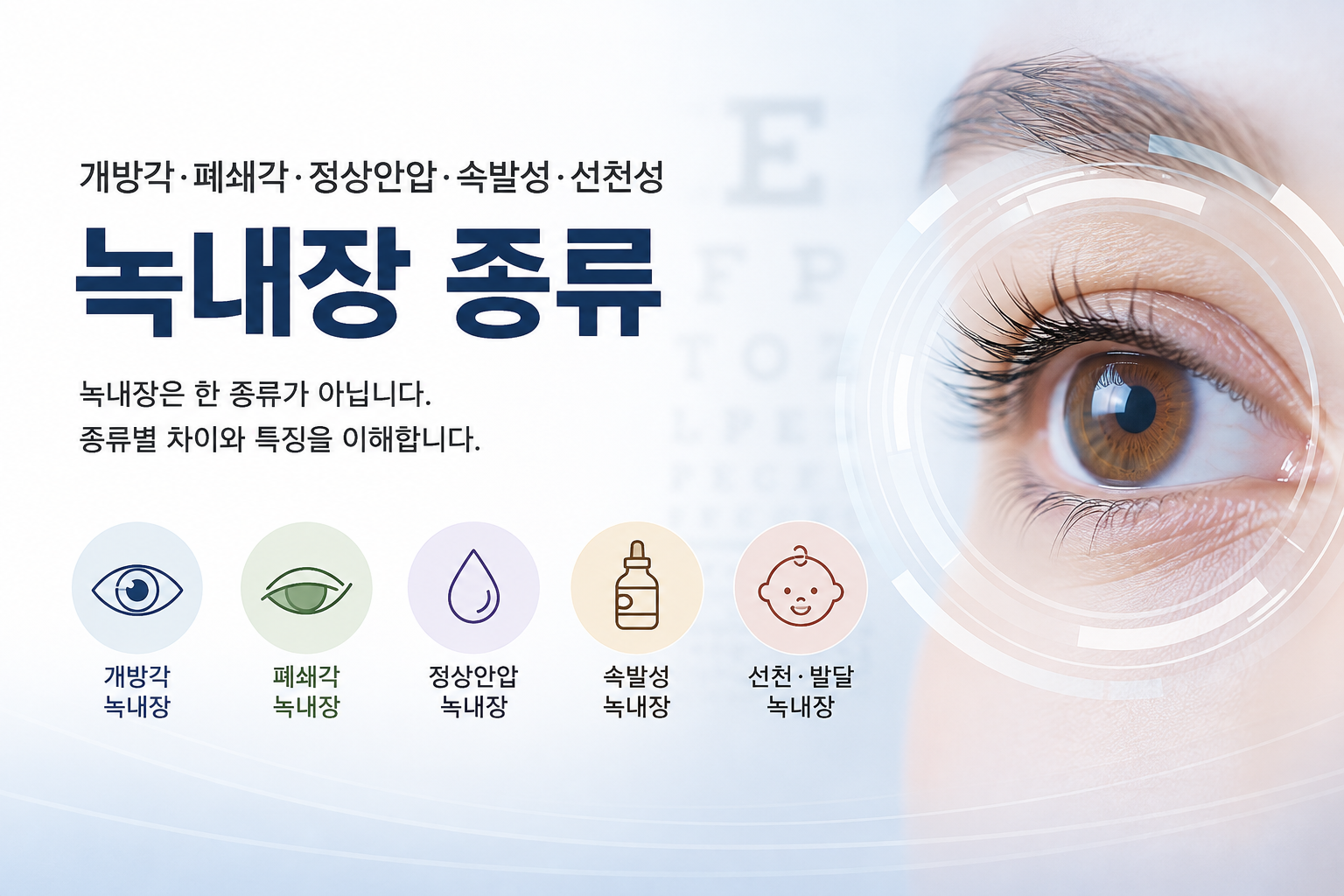 개방각 폐쇄각 정상안압 등 녹내장 종류 설명