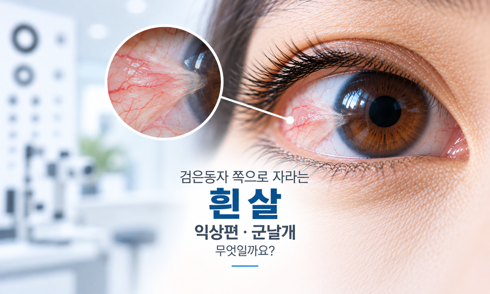 금정역안과 익상편 군날개로 검은 동자가 덮이는 경우